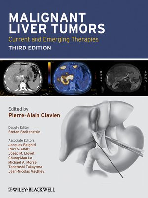 cover image of Malignant Liver Tumors